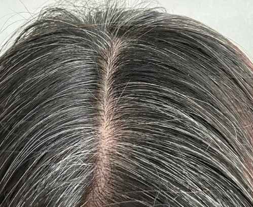 “银发经济”的科技应答:唯秦秘如何让父母的每根白发,都成为健康回归的信号?