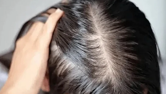 当“发量焦虑”成为这代人的集体情绪,唯秦秘养发如何回应大众诉求