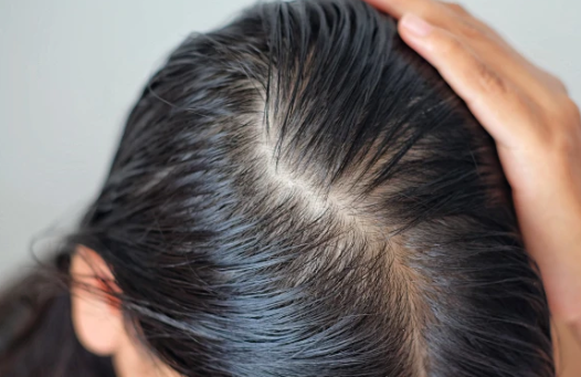 养发行业沉迷营销概念,唯秦秘如何用“一人一方案”重新定义养发服务